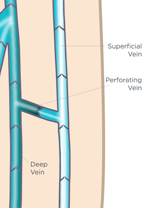 Perforator Vein Anatomy